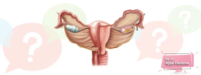 Rahim-(Uterus)-Hastalıkları