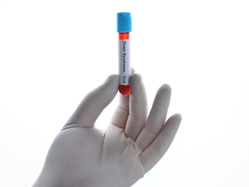 Gelişmiş Down Sendromu Testleri