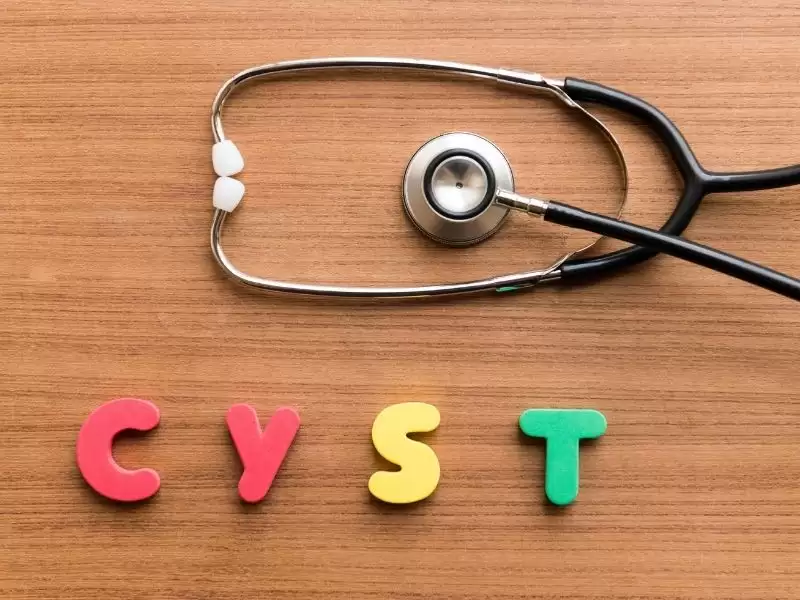 Yumurtalık Kisti Nedir?