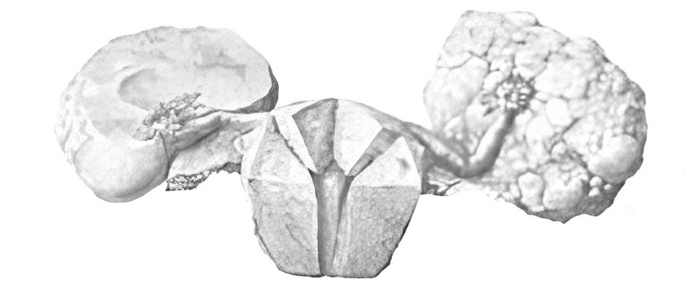 yumurtalik-kanserleri