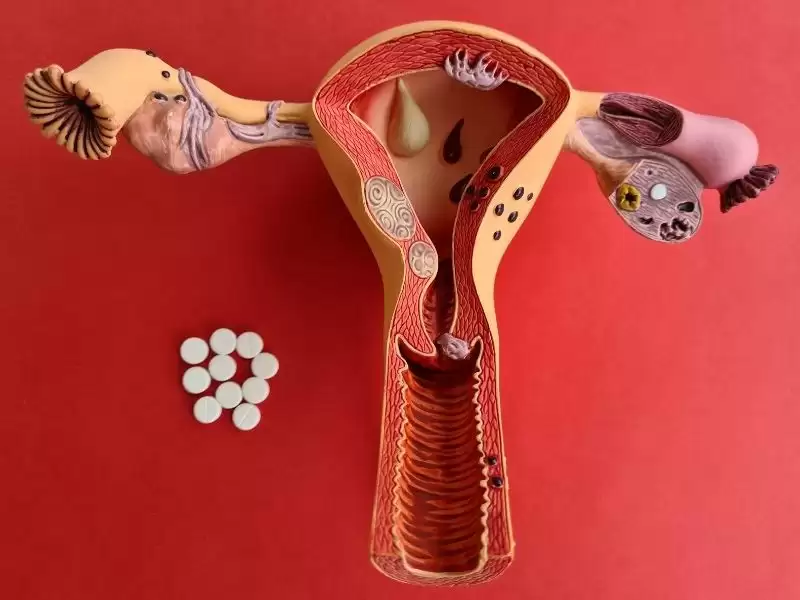 Rahim Ağzı Enfeksiyonu Belirtileri